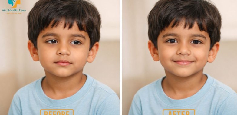 Does Squint Eye Surgery Improve Vision or Just Appearance?